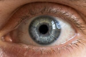Thyroid Eye Disease Affects 16 in 100,000 Women Yearly, Smoking Multiplies Risk