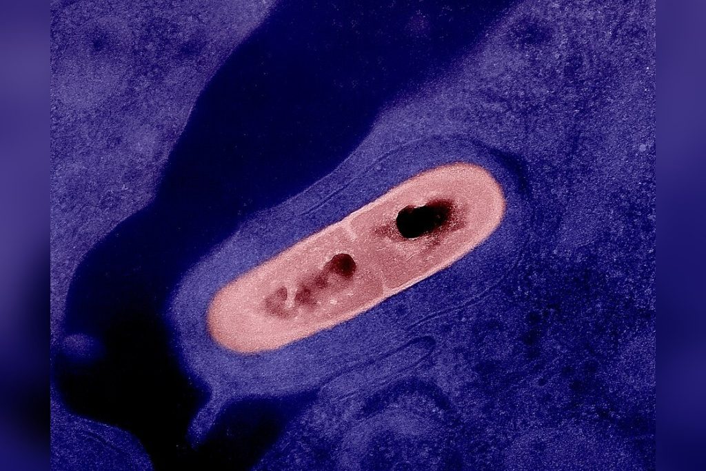Listeria Monocytogenes