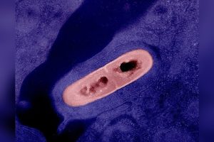Listeria outbreak in California kills infant, sickens 10