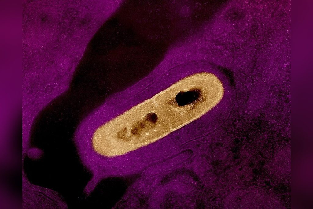 Listeria Monocytogenes
