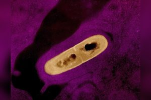 Listeria Outbreak in California Kills Infant, Sickens 10 Others
